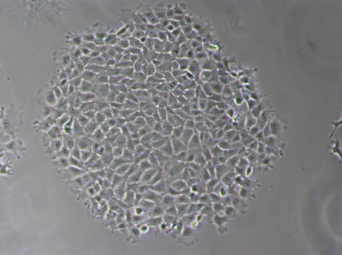 Ilustración cáncer de mama triple negativo