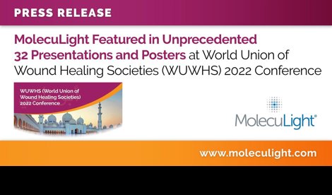 Comunicados Internacional