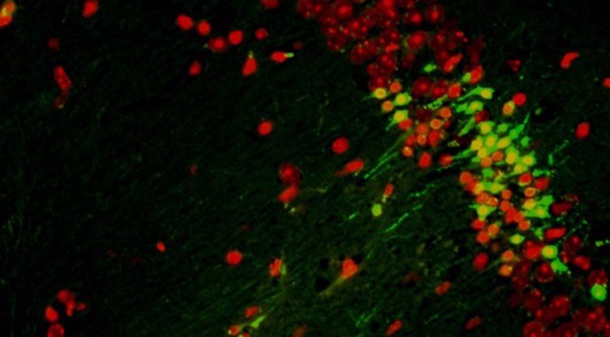 Imagen microscópica de neuronas.