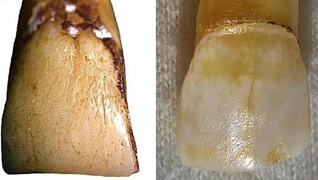 Macaco de la isla de Koshima (izquierda) y neandertal (derecha), ambos incisivos centrales superiores mostrando grandes rasguños verticales.