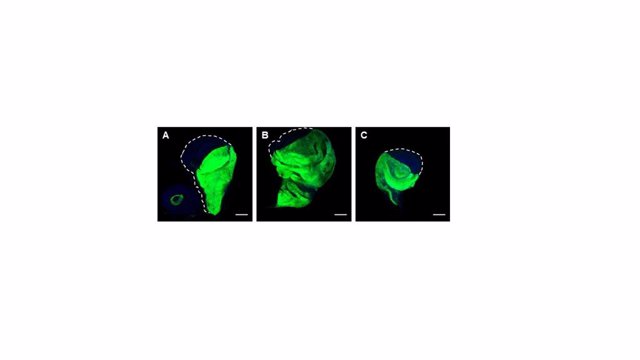 Figura 1: Bloquear Importina-7 permite controlar el tamaño de un órgano. Panel A: Órgano de la mosca de la fruta Drosophila melanoganster normal. Panel B: Órgano sobrecrecido debido a una activación y acumulación de YAP en el núcleo.