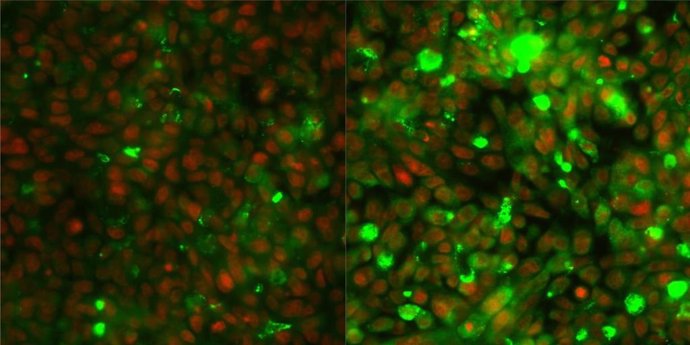 Comparación de células de cáncer colorrectal antes (izquierda) y después (derecha) del tratamiento. La expresión de las mucinas se muestra en verde