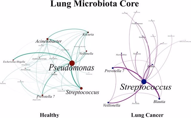 Núcleo de la red compleja de las bacterias en la microbiota de pacientes con cáncer de pulmón comparada con la del grupo control.