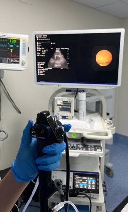 Unos 180 pacientes de Neumología del Hospital Clínico de Málaga se benefician del nuevo equipo de ecobroncoscopias