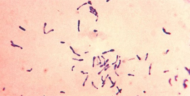 Archivo - Imagen al miscroscopio de Corynebacterium diphtheriae? con tinción, una de las bacterias causantes de la difteria.