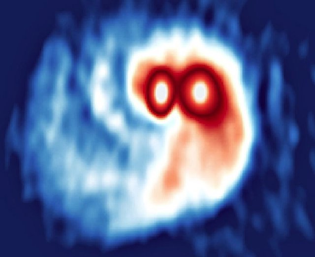 Observaciones realizadas con ALMA del polvo en los discos alrededor de SVS13.