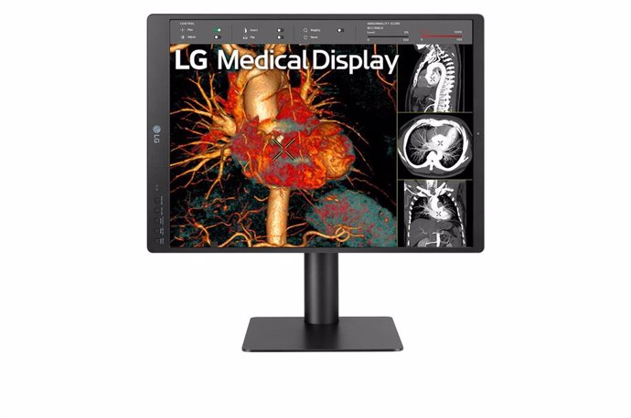 Software de LG para radiografías.