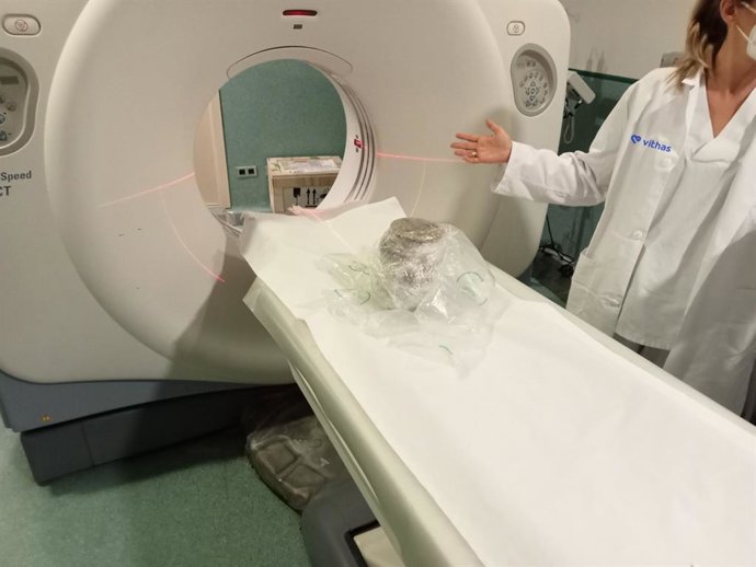 TAC Realizado por Vithas Xanit Benalmádena a una urna funeraria fenicia hallada en Mijas