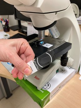 Sanidad extiende el modelo de cribado de cáncer de mama a la detección precoz del cáncer de cuello de útero