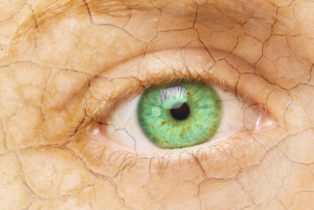 Consejos para prevenir el síndrome de ojo seco