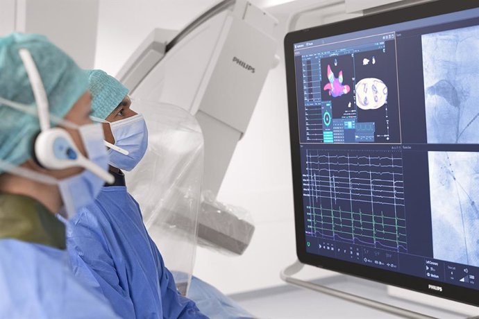 Archivo - Procedimiento con criobalón Philips KODEX-EPD