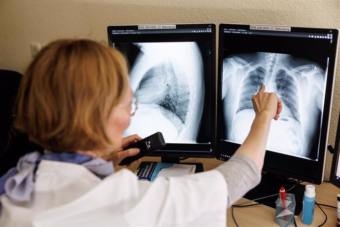 Archivo - 12 March 2022, Bavaria, Gauting: Dr. Natalie Woehrle, radiologist, analyzes the X-ray images of the lungs of a person who has fled from Ukraine in her office at the Gauting Lung Clinic, which is screening refugees from Ukraine for tuberculosis