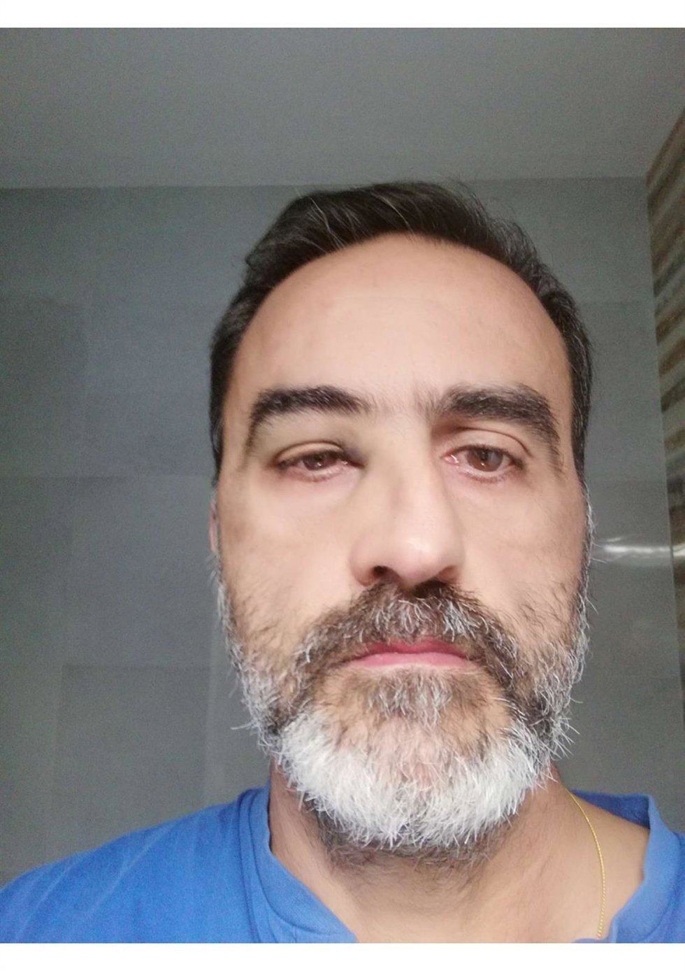 Imagen del taxista afectado por la agresión
