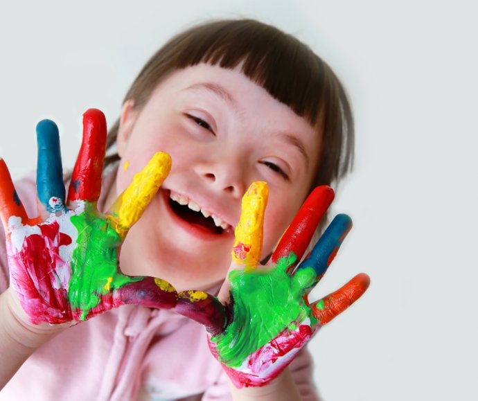 Archivo - Discapacidad.