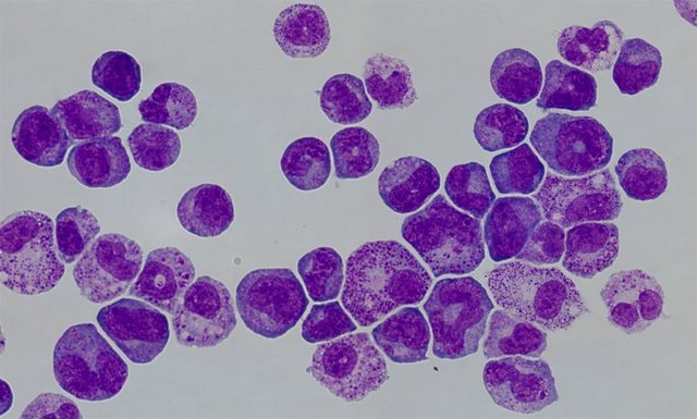 Células madre hematopoyéticas y células proleucémicas en cultivos celulares del estudio del CRG que ha descubierto una nueva diana terapéutica para un tipo de leucemia agresiva