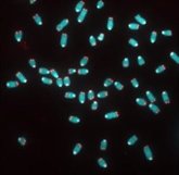 Foto: La longitud de los telómeros está relacionada con el riesgo de muerte por COVID-19, sobre todo en mujeres