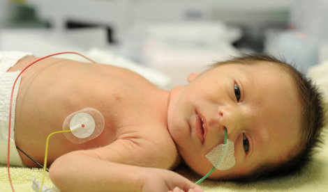 Comunicados Internacional