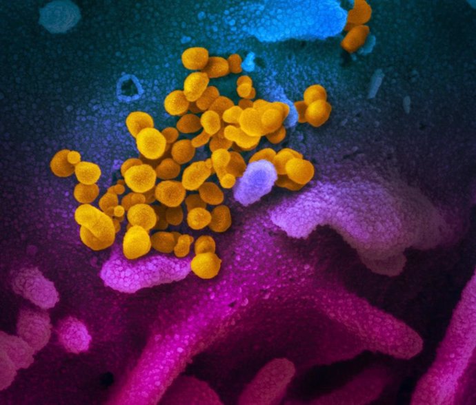 Archivo - Imagen de microscopio electrónico de barrido muestra SARS-CoV-2 (amarillo), también conocido como 2019-nCoV, el virus que causa COVID-19, aislado de un paciente en los EE. UU. ) cultivados en el laboratorio.