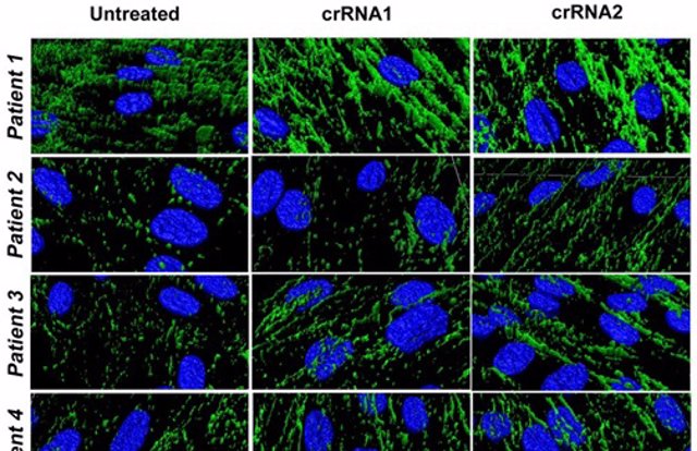 La edición genética por CRISPR/Cas9 abre las puertas a una nueva estrategia terapéutica para las distrofias musculares congénitas por déficit de colágeno VI