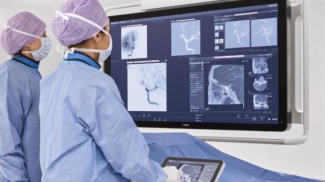 Archivo - La suite Neuro de Philips se basa en el sistema de terapia guiada por imagen Azurion y ofrece los últimos avances en neurorradiología intervencionista.