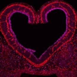Archivo - Vasos sanguíneos en rojo en estrecha comunicación con la proliferación de células neuronales en la corteza del ratón