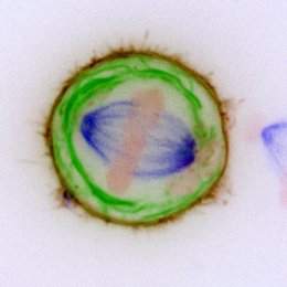 Los cromosomas (mostrados en rosa) son compartidos por el huso (azul). Las membranas (verde) son un factor de riesgo para el correcto reparto de los cromosomas.