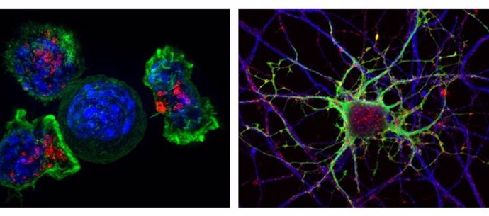 Mágenes (Flickr) al microscopio de células tumorales (izquierda) y de una neurona (derecha). La investigación en la que participa la Escuela Nacional de Sanidad analiza datos biomédicos y sanitarios para tratar de mejorar los estudios que buscan relación