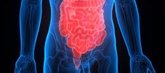 Foto: El tipo de dieta puede aumentar unos gases potencialmente dañinos en el intestino