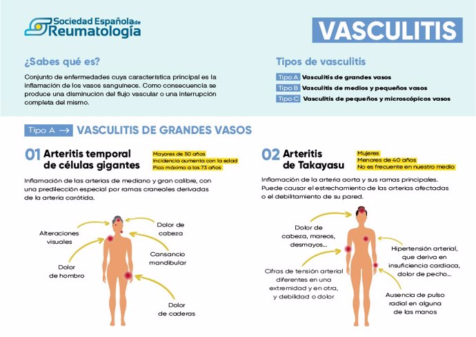 Infografía vasculitis