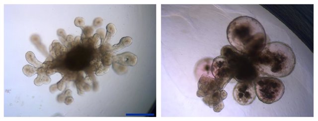 Dos imágenes de los organoides que desarrolla el equipo de Alberto Zambrano en el ISCIII para imitar pulmones humanos en investigaciones llevadas a cabo en laboratorio.