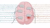 Foto: Investigadores de la UPF proponen un nuevo método para entender el proceso epiléptico