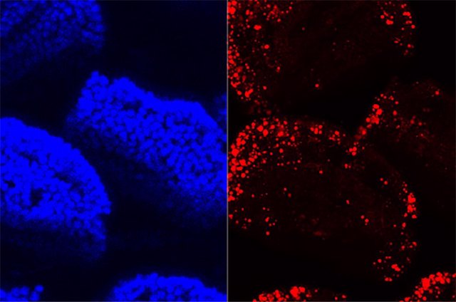 Una imagen de microscopía confocal de vellosidades pequeñas en el intestino delgado muestra los núcleos celulares en azul y la grasa dietética absorbida en rojo.