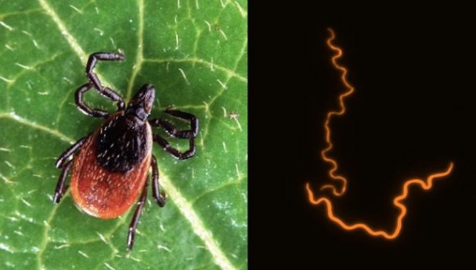 Archivo - Una garrapata de venado (izquierda), una de las especies que transmite las bacterias que causan la enfermedad de Lyme. Imagen de alta resolución etiquetada de forma fluorescente de la bacteria B. Burgdorferi que causa la enfermedad de Lyme (de
