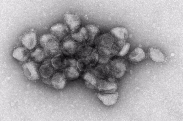 Imagen de microscopía electrónica de un agregado de partículas virales pseudotipadas con la proteína de espiga de la variante Delta del SARS-CoV-2.