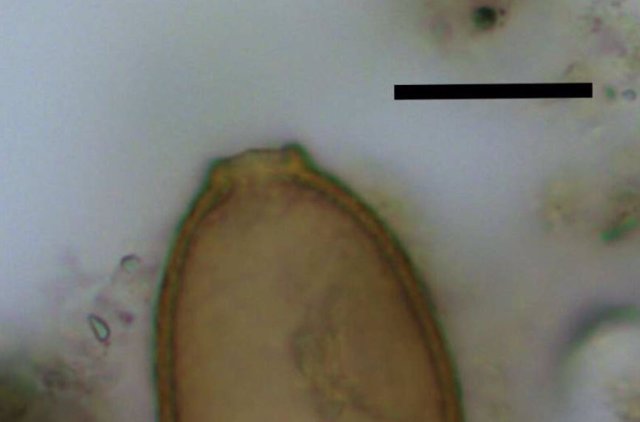Huevo microscópico de gusano capillariido de Durrington Walls. La barra de escala negra representa 20 micrómetros.