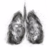 Foto: Claves sobre la enfermedad pulmonar intersticial, patologías que provocan inflamación o cicatrización de los pulmones