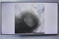 Sanidade confirma el primer caso de viruela del mono en Galicia