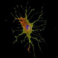 Investigadores del CSIC utilizan bacterias para 'entrenar' a los linfocitos del sistema inmunitario