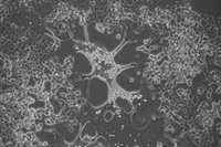 Científicos modifican el virus del herpes para investigar su potencial contra el cáncer