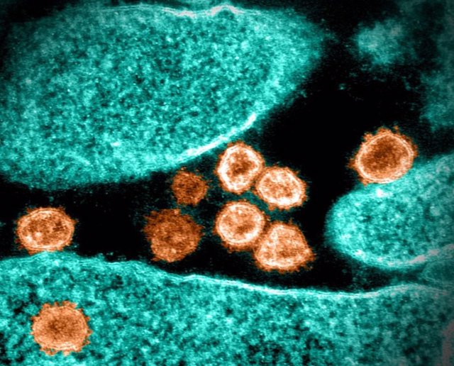 Imagen de microscopio electrónico de transmisión de partículas del virus del SARS-CoV-2 emergiendo de la superficie de una célula cultivada en el laboratorio.