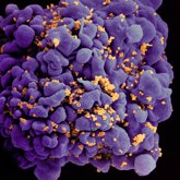 Foto: La combinación de dos anticuerpos contra el VIH puede suprimir el virus durante un periodo prolongado