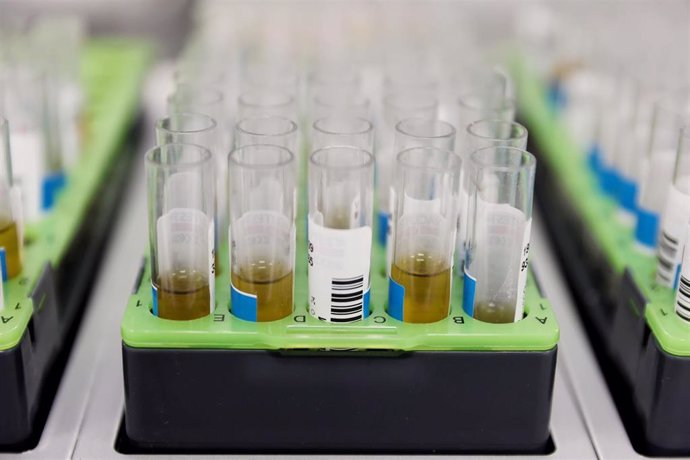 Probetas de pruebas PCR en el Laboratorio de Microbiología del Hospital público Gregorio Marañón, a 31 de mayo de 2022, en Madrid (España). El centro hospitalario, junto a otros cuatro en la región, ha comenzado a realizar pruebas PCR para la viruela de
