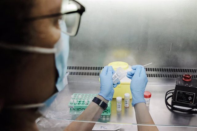 Una técnico de laboratorio sostiene una de las pruebas de análisis para la viruela del mono, en el Hospital Ramón y Cajal, a 30 de mayo de 2022, en Madrid (España). 