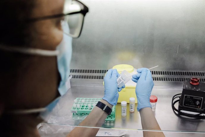 Una técnico de laboratorio sostiene una de las pruebas de análisis para la viruela del mono, en el Hospital Ramón y Cajal, a 30 de mayo de 2022, en Madrid (España). La Comunidad de Madrid empieza hoy a realizar en cinco hospitales públicos de la región 