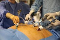 La cirugía para perder peso reduce el riesgo de cáncer y la mortalidad