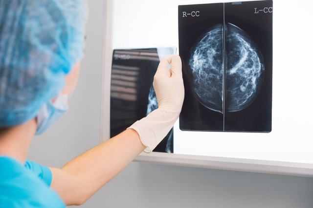 Archivo - Woman doctor or nurse in surgery outfit is holding a mammogram in front of x-ray illuminator