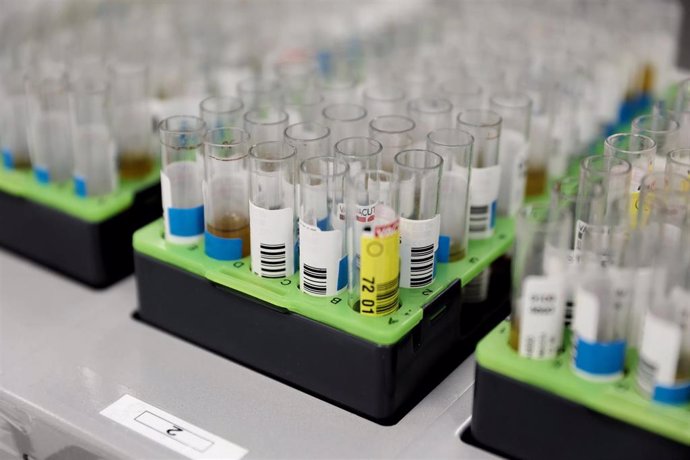Probetas de pruebas PCR para la viruela del mono en el Laboratorio de Microbiología del Hospital público Gregorio Marañón.
