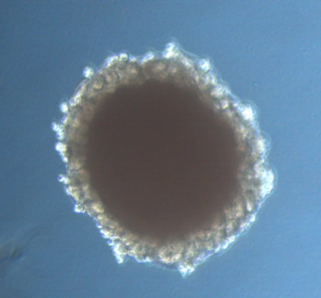 Archivo - Imagen de campo brillante de un organoide renal generado a partir de células madre pluripotentes humanas.