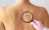 Foto: El cáncer de piel es prevenible y curable en más de un 90% de los casos no melanoma si se trata a tiempo