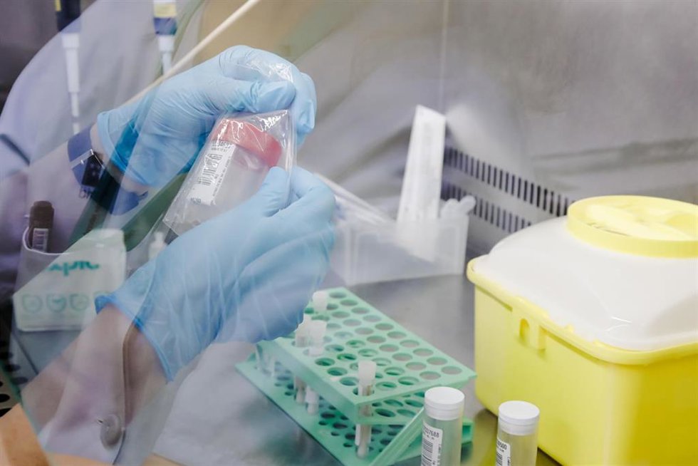 Imagen de archivo de una técnico de laboratorio sostiene una de las pruebas de análisis para la viruela del mono